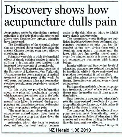 acupuncture-pain-adenosine-nzherald