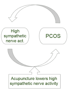 Acupuncture PCOS