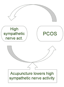Acupuncture PCOS