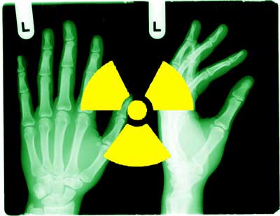 CT radiation risks Xray