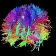 Transcranial current stimulation