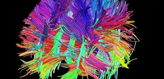 Transcranial current stimulation